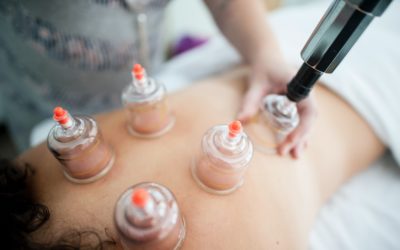 De meerwaarde van cuppingtherapie tijdens een massage