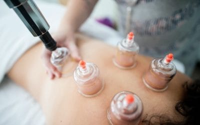 De meerwaarde van cuppingtherapie tijdens een massage